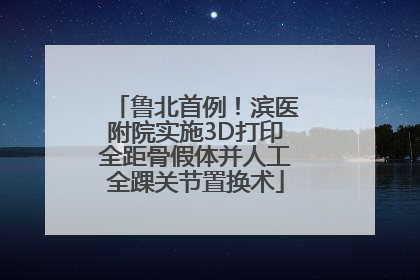 鲁北首例！滨医附院实施3D打印全距骨假体并人工全踝关节置换术